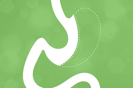 Gastric Sleeve Surgery in Tijuana, Mexico