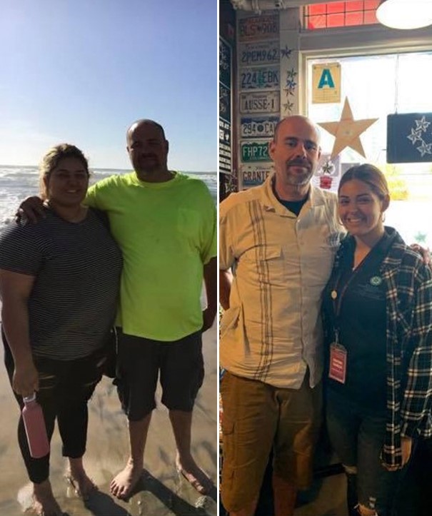 Before and After Results of Patient Undergoing Bariatric Surgery in Tijuana