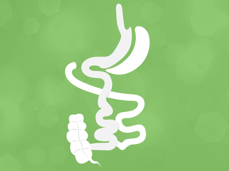 Duodenal Switch Surgery