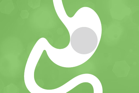 IntraGastric Balloon Procedure