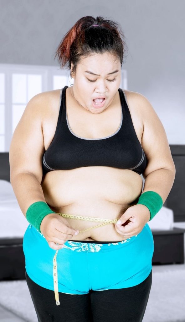 Lady Thinking About Gastric Bypass Surgery Procedure in Tijuana, Mexico