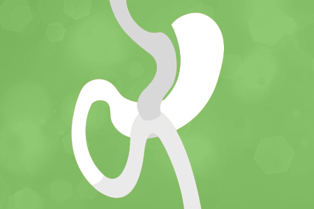 Mini-Gastric Bypass Surgery in Tijuana