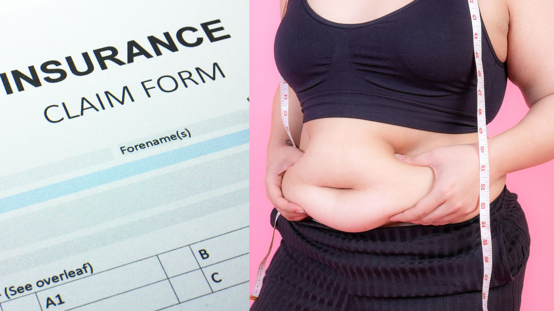 Will Insurance Cover Your Weight Loss Surgery? Let’s Find Out